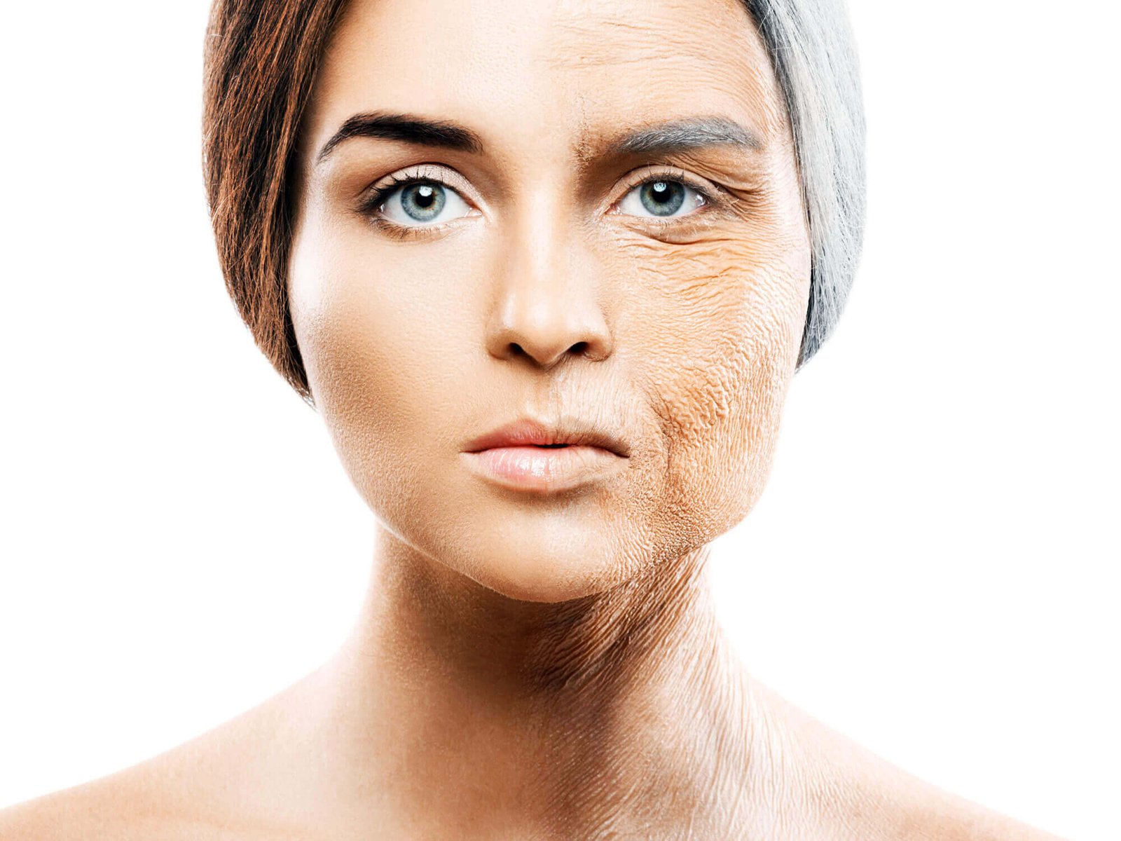Dry Skin and Wrinkle Formation